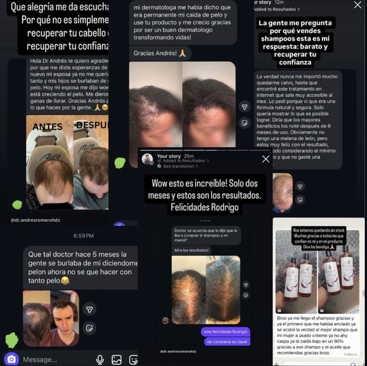 EXCALVO SHAMPOO